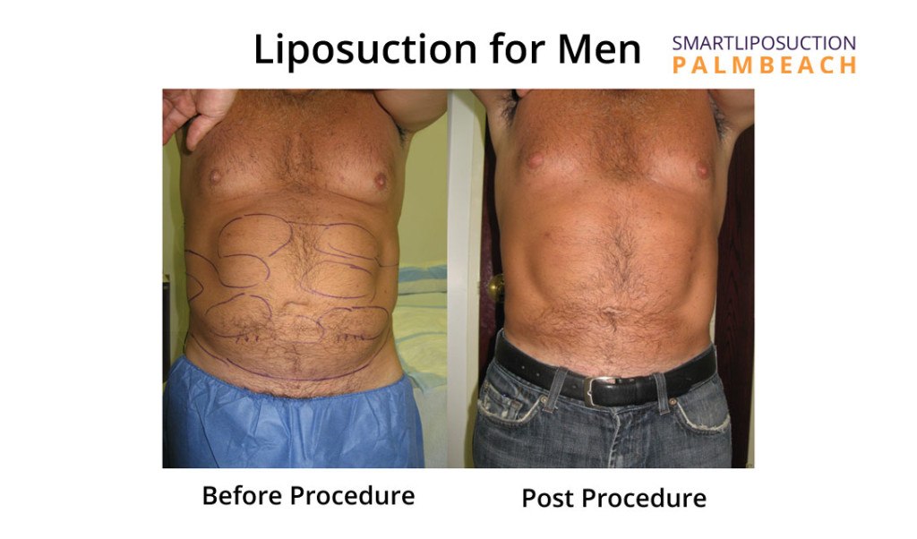 for-men