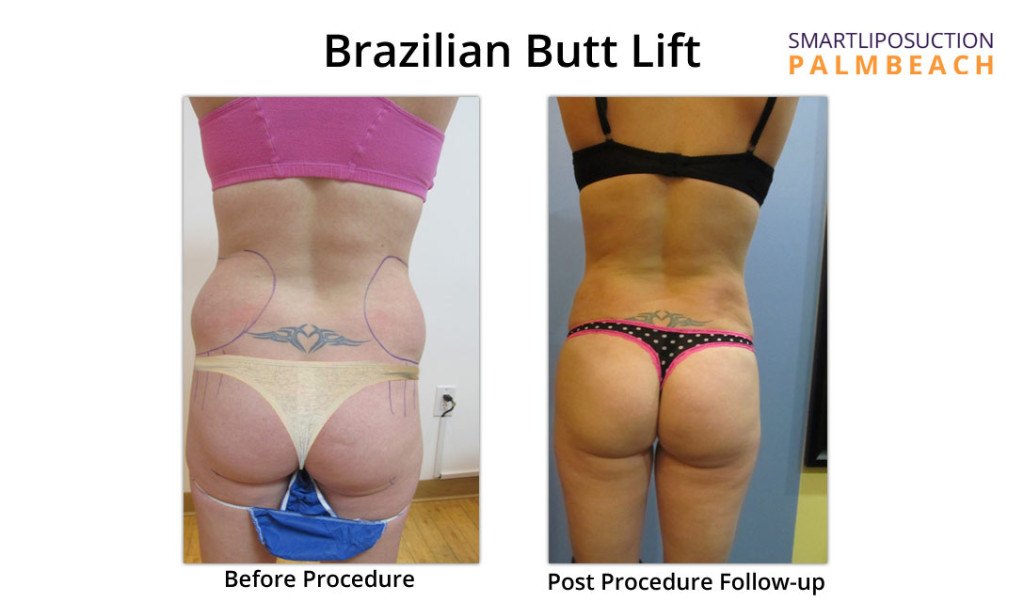 kristyback1