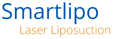 Smart Liposuction logo